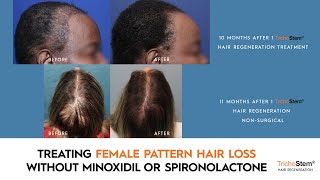 Using Texture Spray On Your Hair  How To Apply Texture Spray The Benefits amp Final Results [upl. by Mloc]