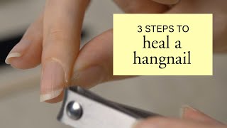 3 Steps to Heal a Hangnail [upl. by Lubow]