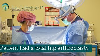 Hip Arthroplasty and Piriformis Syndrome [upl. by Eerpud309]