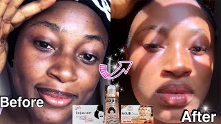 1 MONTH SKIN TRANSFORMATION Detailed Kojic acid Products Review And skincare products for beginners [upl. by Fatma]