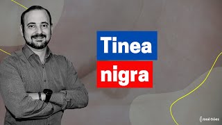 Tinea nigra  José Góes [upl. by Annaik]