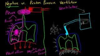 Negative vs Positive Pressure Ventilation [upl. by Gilman]