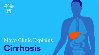 Mayo Clinic Explains Cirrhosis [upl. by Aikenahs]