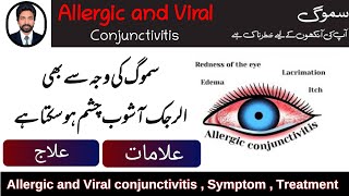 Smog Effect On Eyes  Allergic and Viral Conjunctivitis  Symptom Treatment Nafamine DrAHMandal [upl. by Ssecnirp83]