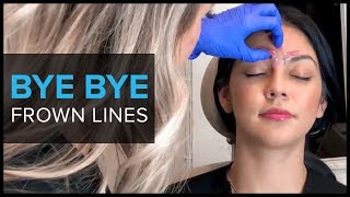 Why We Use BOTOX For Frown Lines [upl. by Joshua]