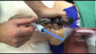 Direct amp Video Laryngoscopy [upl. by Brand133]