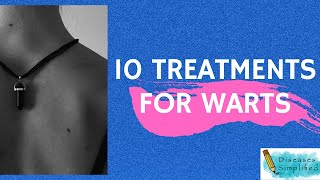 10 Treatments for Warts [upl. by Elbas]