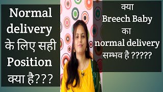 Which baby position is best for normal delivery Variable positions of Baby by Dr Pratibha [upl. by Evars27]