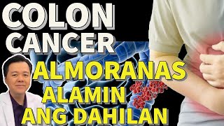 Colon Cancer Almoranas Alamin ang Dahilan Paano Maiiwasan  Payo ni Doc Willie Ong 295c [upl. by Bourke]