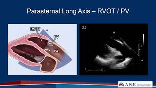 Part 2 Comprehensive TTE in Adults Webinar [upl. by Hiltan]