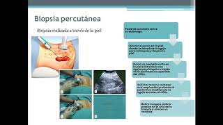 Biopsia Renal  Danna Calderón [upl. by Assirak]