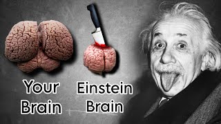 What Happened to Einsteins Brain After He Died [upl. by Airdnal434]