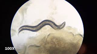 C elegans Under the Microscope [upl. by Eldin]