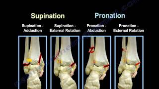 Ankle Fractures Lauge Hansen Introduction  Everything You Need To Know  Dr Nabil Ebraheim [upl. by Nirag]