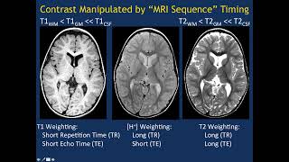 MRI Basics Part 1 [upl. by Gayle147]