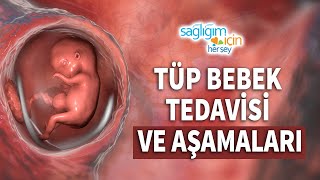 Tüp Bebek Tedavisi ve Aşamaları [upl. by Heidt]