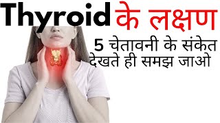 Thyroid ke lakshan kya hai  Thyroid symptoms in Hindi [upl. by Alanna98]