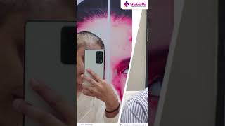 Success Story Alopecia Areata Treatment  Patient Testimonial  Dr Sonali Gupta [upl. by Hanonew661]