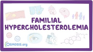 Familial hypercholesterolemia  an Osmosis Preview [upl. by Schuler480]