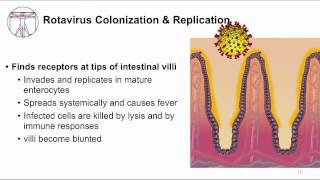 Acute GI Watery diarrhea and viruses [upl. by Gonzalo757]