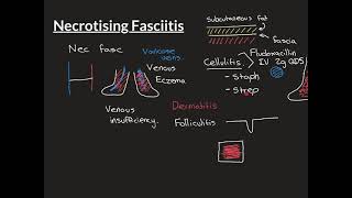 Necrotising Fasciitis [upl. by Nivloc931]