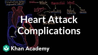 Complications after a heart attack myocardial infarction  NCLEXRN  Khan Academy [upl. by Samalla470]