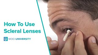 How To Insert and Remove Scleral Lenses [upl. by Ehav]