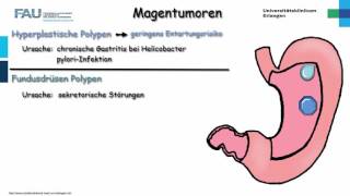 Pathologie ─ Magentumoren [upl. by Trista]