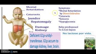 3 Minutes Galactosemia Causes Symptoms Types Genetic Testing Treatment Safe food USMLE NCLEX 300 [upl. by Columbus]