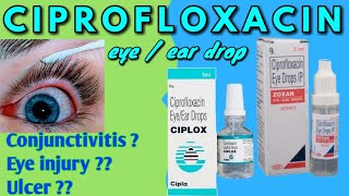 How to put in your eye drops for glaucoma patients [upl. by Longfellow515]