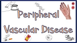 Peripheral Vascular DiseasePVD Causes Signs amp Symptoms Diagnosis ampTreatment [upl. by Suoicerpal]