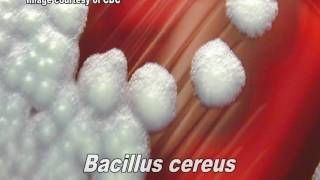 Bacillus cereus [upl. by Bertolde]