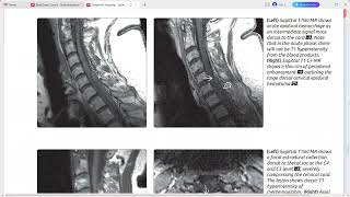 SPINE IMAGING DIAGNOSTIC IMAGING SERIES [upl. by Ryon]