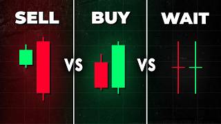 The BEST Candlestick Pattern Guide Youll EVER FIND [upl. by Yssej]