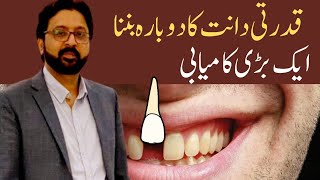 How to REGROW Your Teeth Naturally with a Japanese Research Medicine [upl. by Selinda]