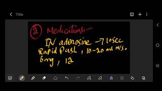 Supraventricular Tachycardia svt [upl. by Filahk]