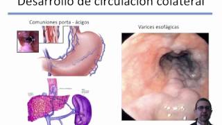 Tema 9 Síndrome ictérico Insuficiencia hepática hipertensión portal umh1931 [upl. by Riaj324]