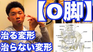 【O脚 治し方】「治せるO脚」と「治せないO脚」の見極め方！【O脚・X脚・XO脚（膝下O脚）】 [upl. by Wendall]