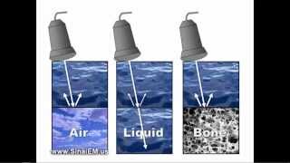 Ultrasound Basics [upl. by Vedetta956]