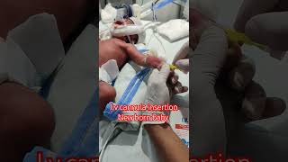 I v cannula insertion New born baby boy NICU care neonatal baby 😘viral nicu newborn reels cute [upl. by Colon]