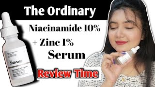 আসল নকল চেনার উপায়  THE ORDINARY Niacinamide 10  Zinc 1 Serum Review  MAKEUP MISTRESS [upl. by Sidnak20]