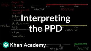 Interpreting the PPD  Infectious diseases  NCLEXRN  Khan Academy [upl. by Eerat]