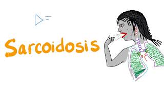 Sarcoidosis  Restrictive Lung Disease  Pulmonology [upl. by Adali938]