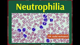 Neutrophilia and Neutropenia Causes amp Evaluation [upl. by Dennis845]