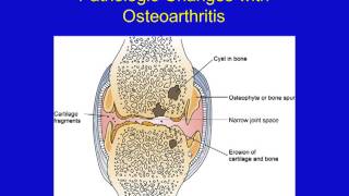 Musculoskeletal Disorders [upl. by Elreath965]