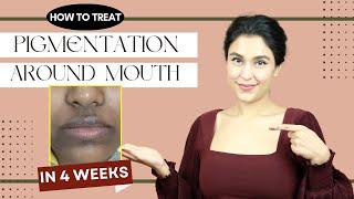 How To Treat PIGMENTATION Around Mouth  Chetali Chadha [upl. by Iderf91]