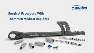 Thommen Medical Complete Surgical Procedure SPI®ELEMENT amp SPI®CONTACT [upl. by Elberfeld952]