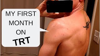 My First Month on TRT  Testosterone Replacement Therapy [upl. by Socin]