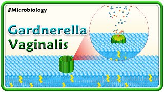 Gardnerella Vaginalis  Microbiology USMLE Step 1 [upl. by Corkhill]