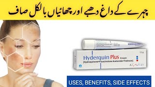 How To Treat Pigmentation  Chehre ki Chaiyon ka Ilaaj [upl. by Mclaurin]